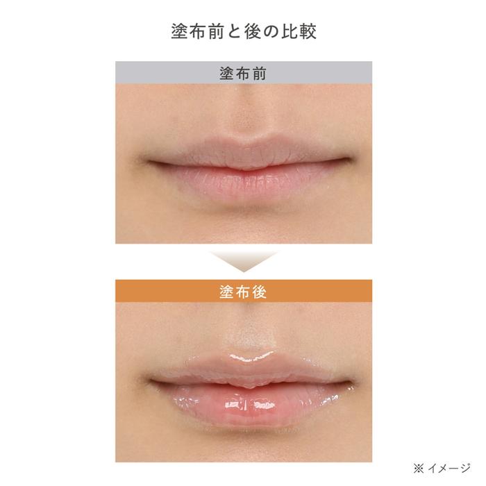 EST The Lip Serum – Moisturizing & Plumping Lip Beauty Serum 10g [Alcohol-free]