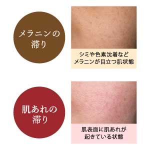 SEKKISEI - (Dermocosmetics) Brightening lotion 200ml [With alcohol]