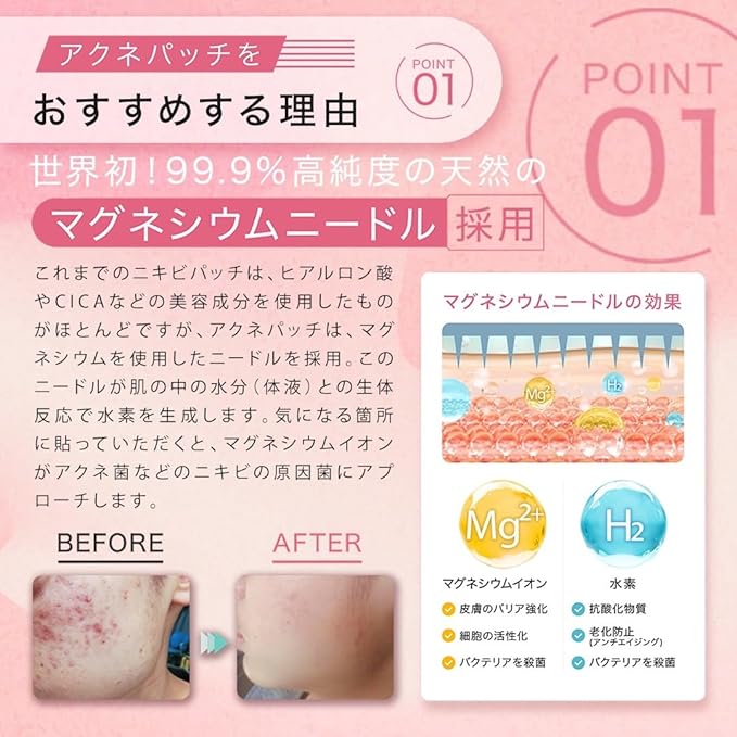 Premium Sakura Acne Patch (S) – Magnesium Needle Patches for Sensitive Skin (20 Pieces) [Alcohol-Free]