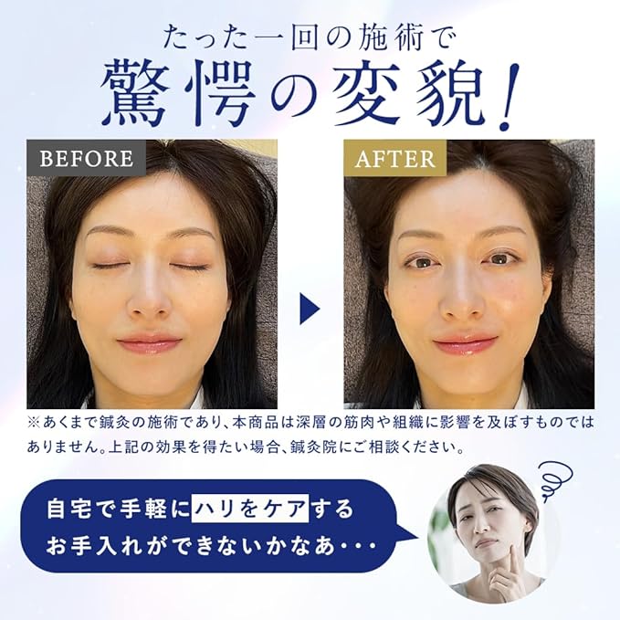 Derma Charge Spot Cream – Intensive Aging Care Serum with Retinol, Niacinamide, and Microcurrent Technology 10g [Alcohol-Free]