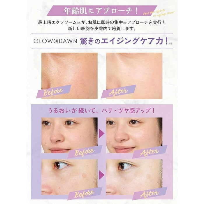 GLOW@DAWN 1st High-Concentration Exosome with VC Serum 30ml [No Alcohol]