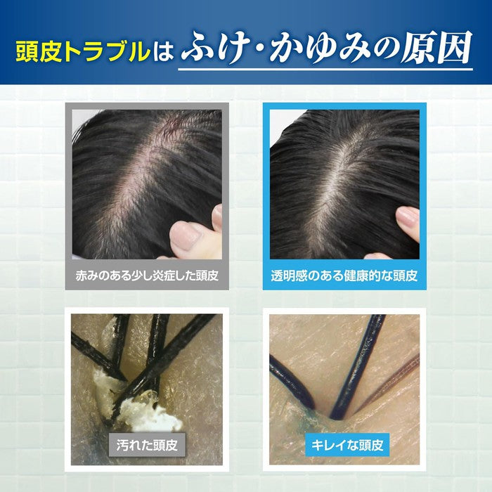 Kaminomoto Medicinal Hair Conditioner B&P 300ml [With alcohol]
