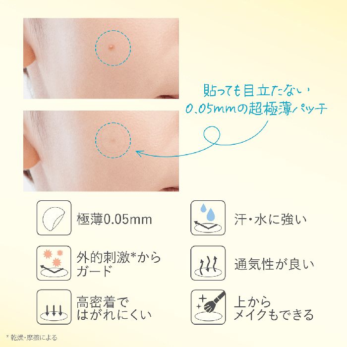 Kose Clear Turn Sorry, Bare Skin Kinishinai Pimple Patch – Invisible Spot Care 46patches [With alcohol]